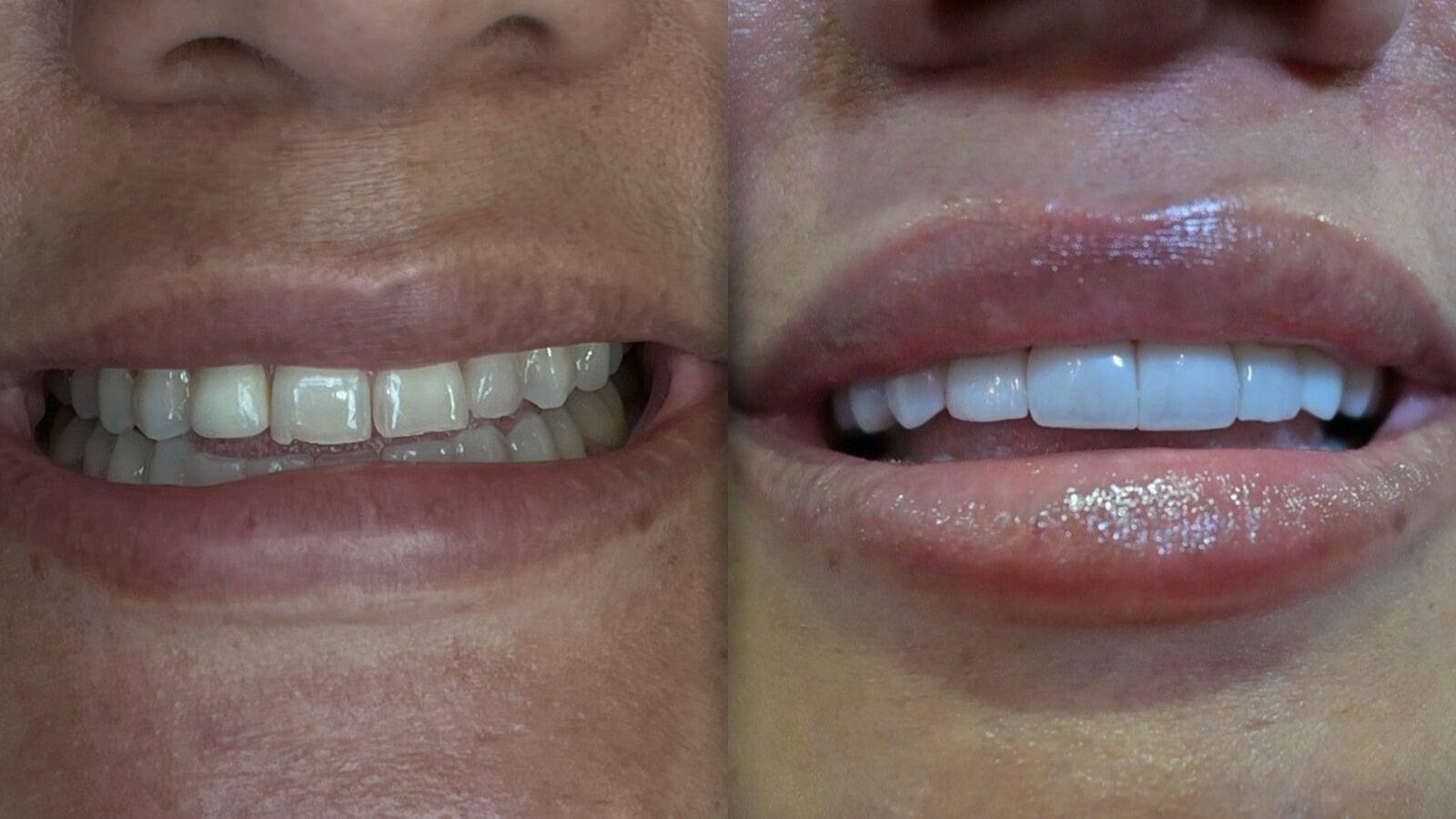 Bicycle Section Image