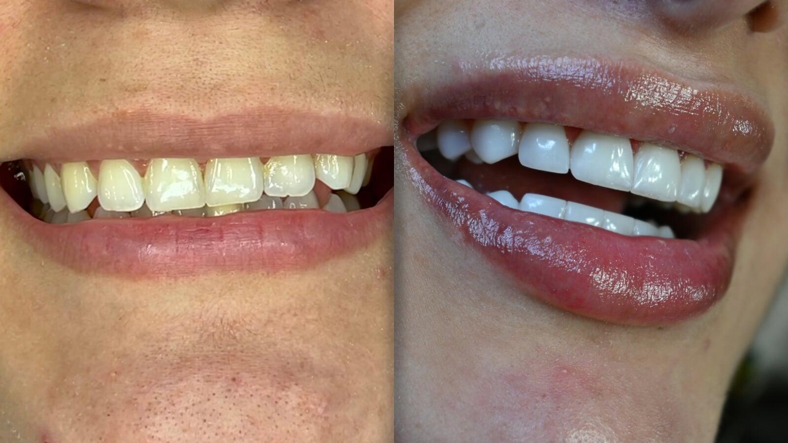 Bicycle Section Image