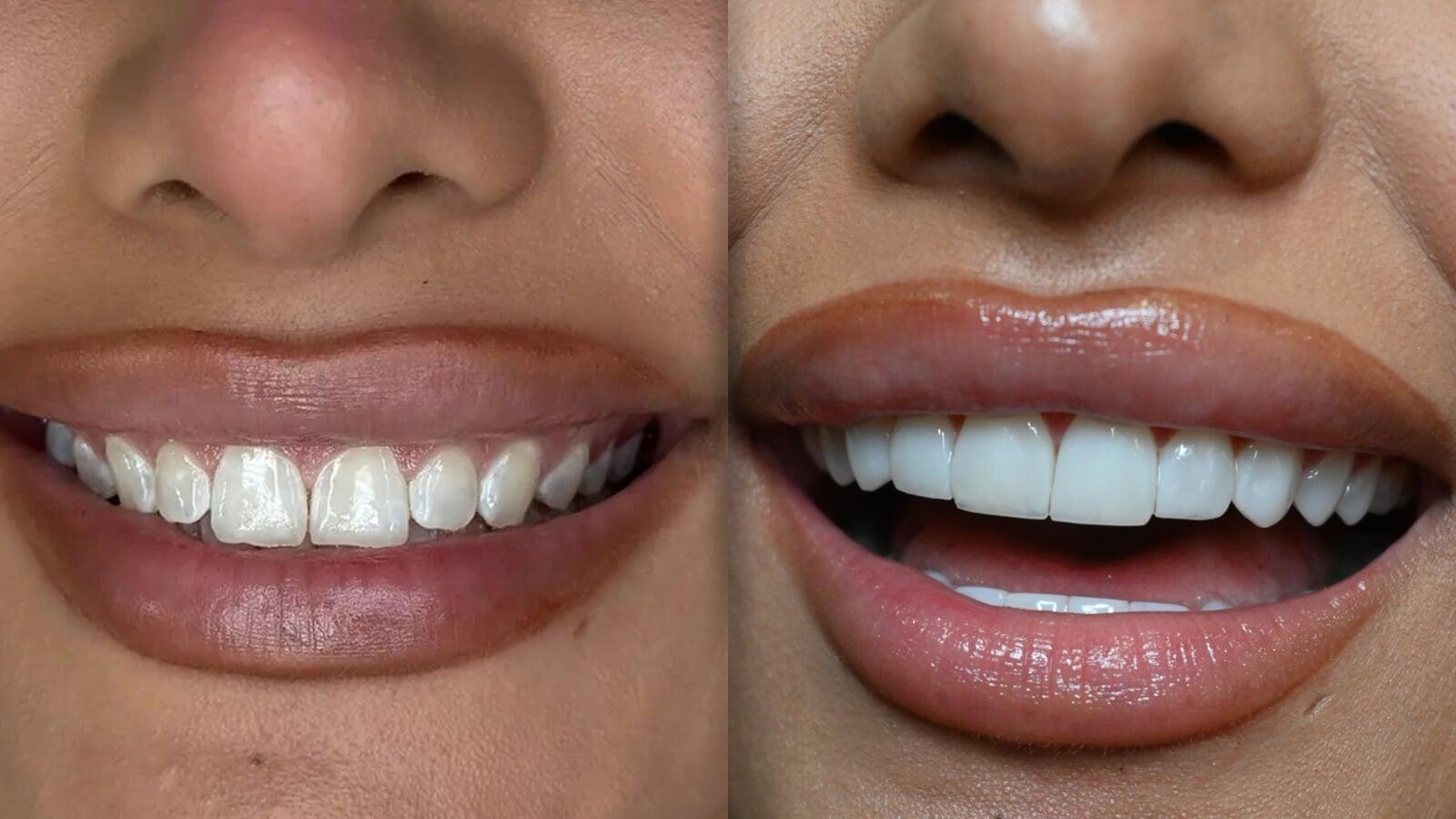 Bicycle Section Image